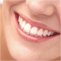 Gardena Teeth Whitening